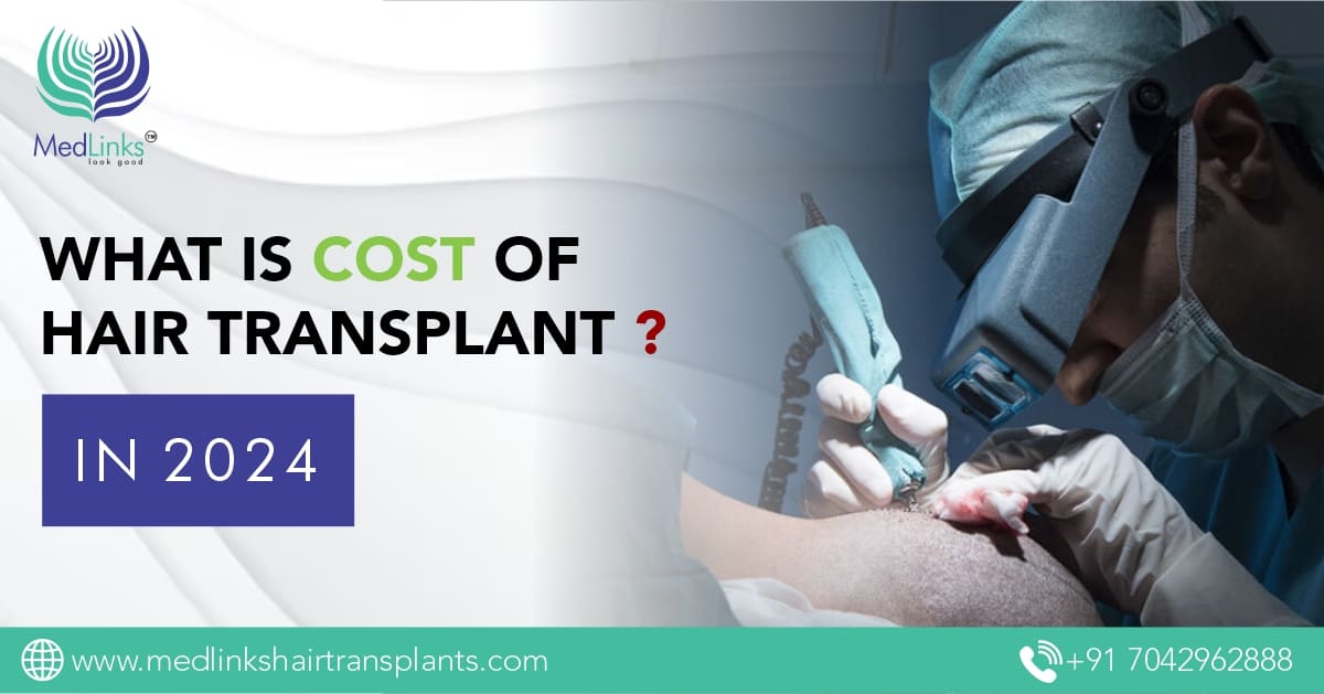 What is the Cost of Hair Transplant In 2024?