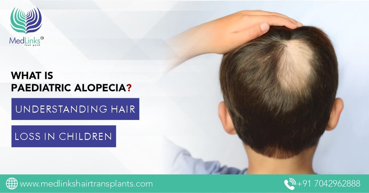 What is Paediatric Alopecia? Understanding Hair Loss in Children